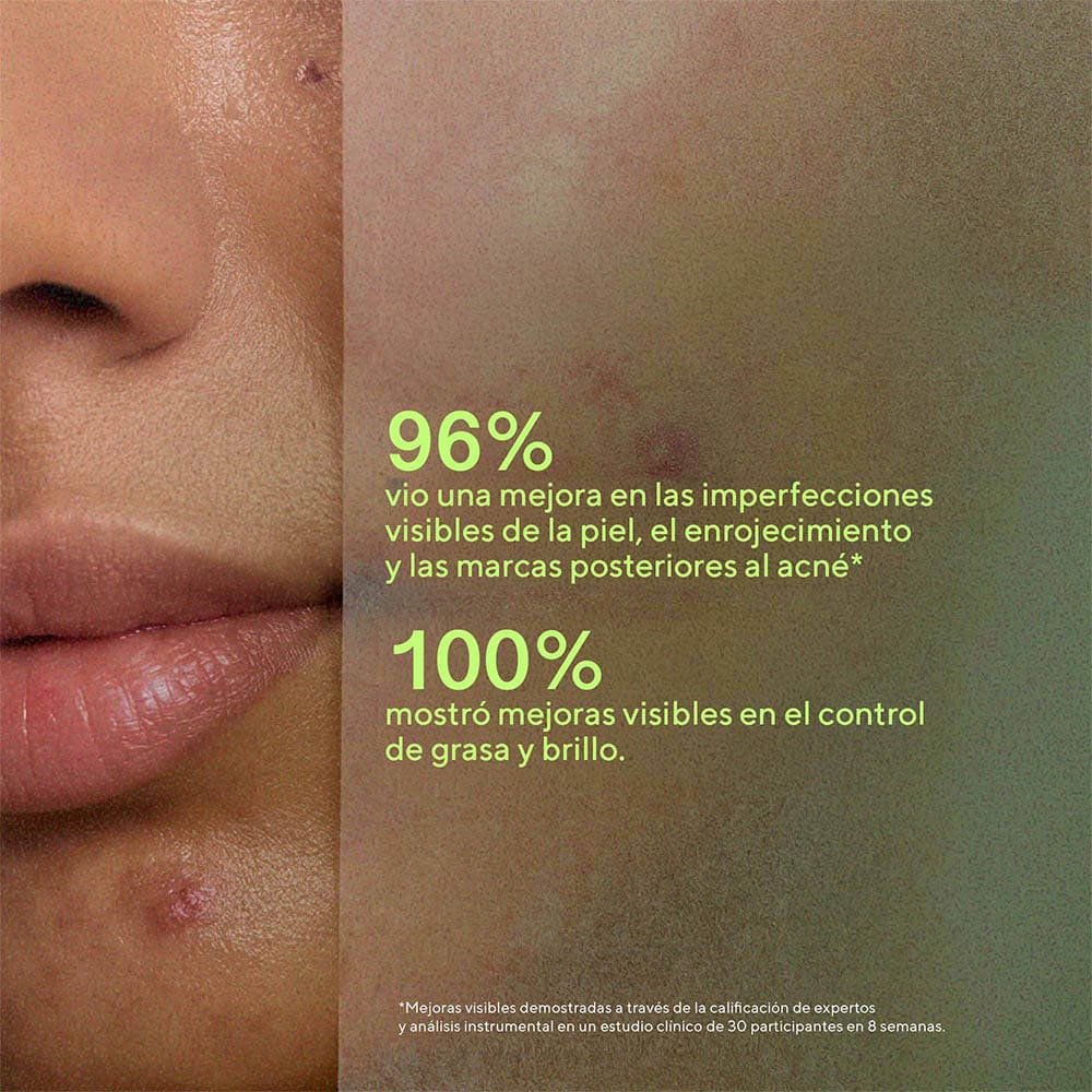BIOME BALANCING CALM + RECOVER CREAM POST-ACN&Eacute; (CREMA FACIAL CALMANTE REPARADORA)